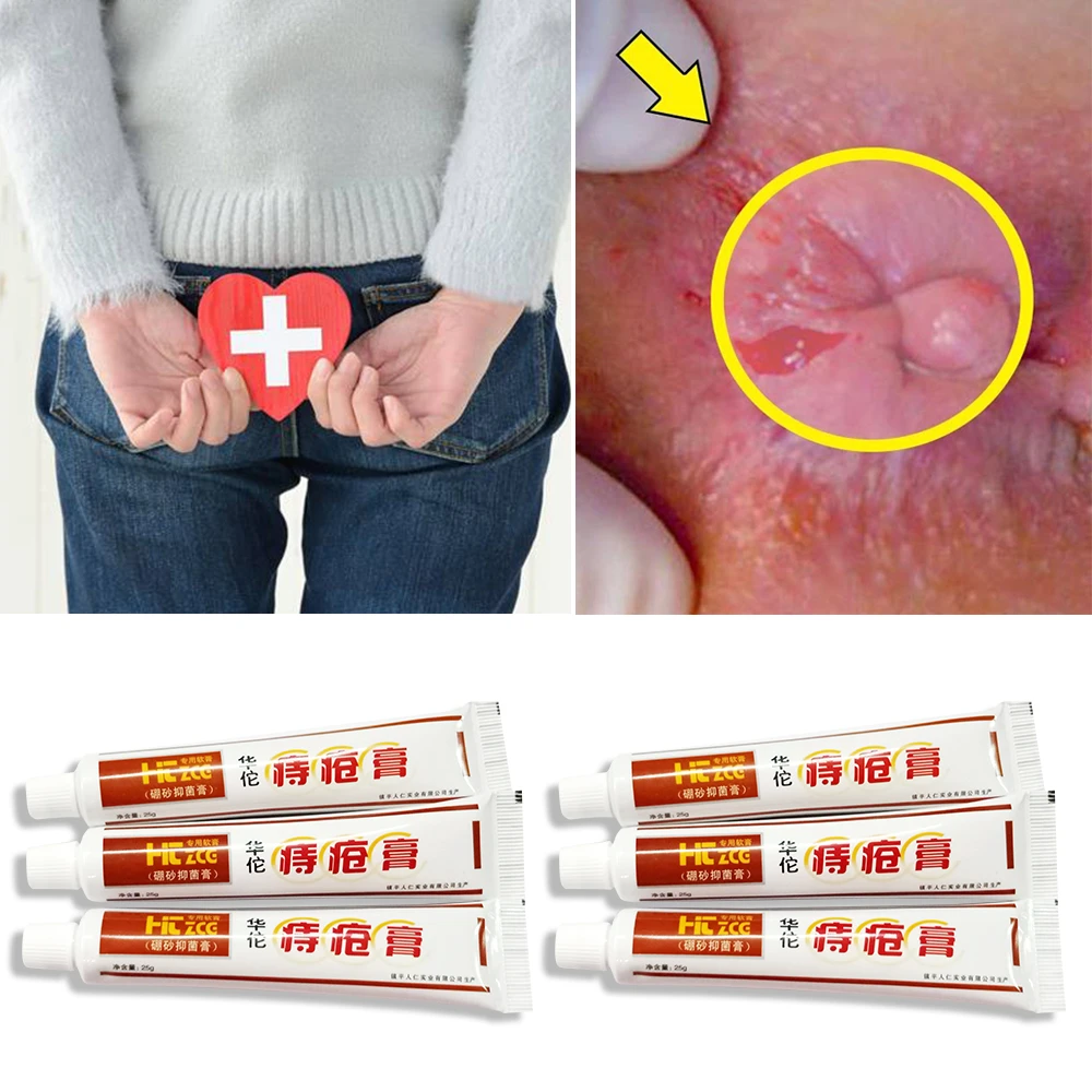 hemorrhoid cream for acne