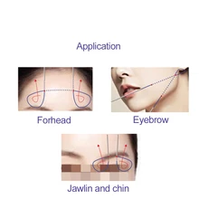 

Deenora Disposable Absorbable Suture W Needle Molding Cog 20g 130mm 400mm Double Needle Pcl Pdo Thread For Face Lifting 1Pcs/Bag