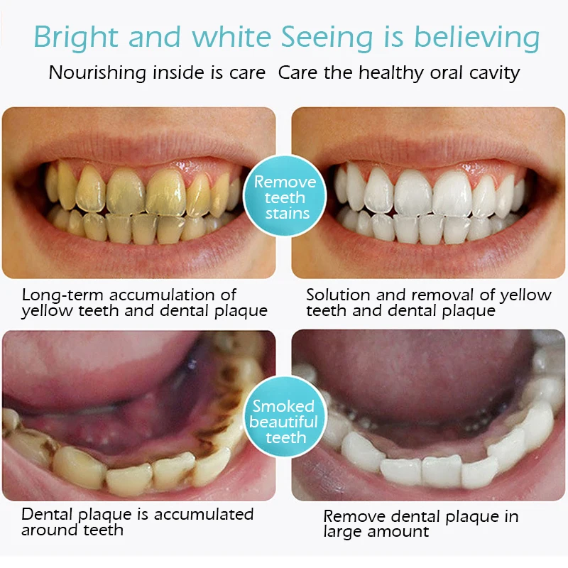 Tooth Cleaning Mousse Fresh Shining Toothpaste Teeth Whitening Remove Plaque Stains Bright Teeth Portable Dental Tool 4