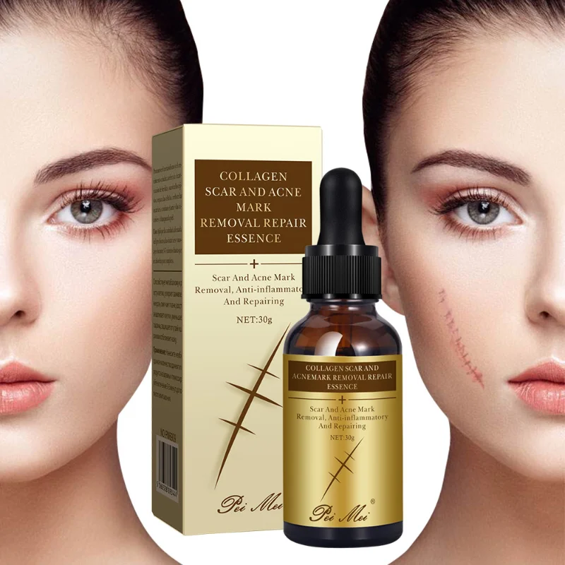 

Collagen Scar Essence Smoothes Scars Removes Acne Nourishes And Repairs Burns Stretch Marks Centella Asiatica Skin Care 30g