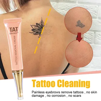 

Permanent Tattoo Removal Cream No Need For Pain Removal Maximum Strength