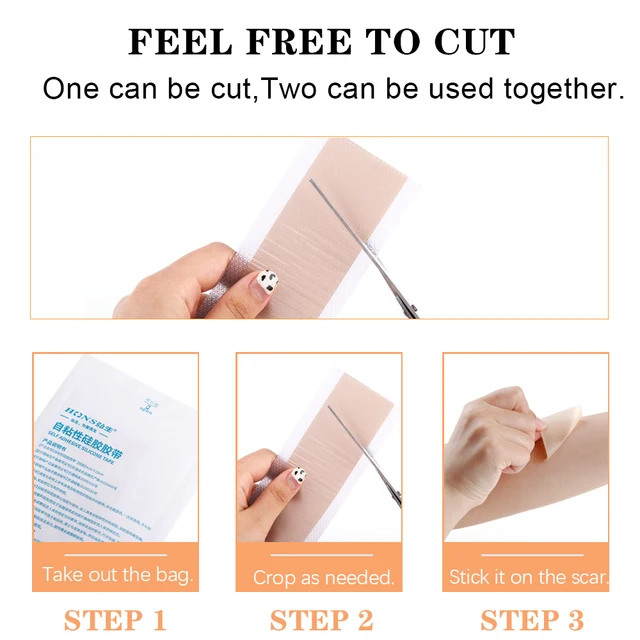 4x50cm Surgery Scar Removal Silicone Gel Patch Treatment Tape Efficient Acne Trauma Burn Scar Therapy Sheet Skin Repair Tools 2