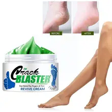 Hand Foot Cream Repair Feet Cream Heel Cracked Repair Dead Skin Care Frostbite Feet Remove anti-Drying Oil Hand Callus
