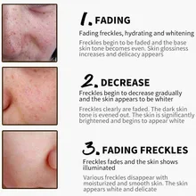 Веснушки крем для защиты от морщин лица пятна темного пятна пигментации кожи отбеливающий крем YUF99