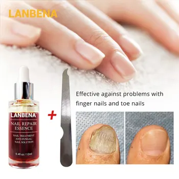 

LANBENA Nail Repair Essence Serum Fungal Nail Treatment Remove Onychomycosis Toe Nourishing Brighten Hand Foot Skin Care 12ml
