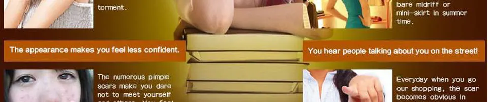 LANBENA восстанавливающий крем для лица от акне и пятен, лечение угрей, отбеливающий крем от растяжек, удаление шрамов, крем для кожи, 30 мл