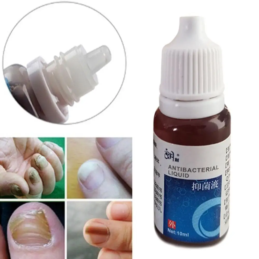 Прим. Экзодерил р-р наружн 1% фл 10мл. Раствор против грибка ногтей. Китайское средство для ногтей. Средство от грибка ногтей лоцерил.