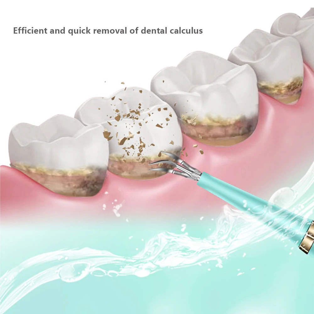 Профессиональный электрический звуковой стоматологический скалер портативный стоматологический инструмент для удаления зубного камня