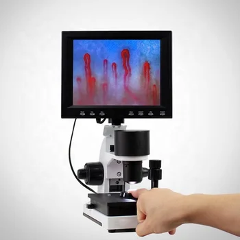 

Nail fold blood microcirculation test machine