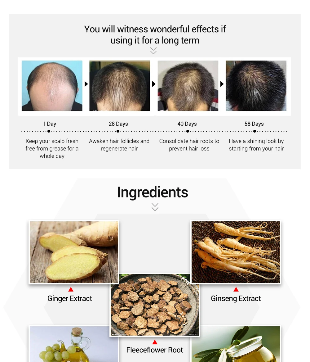 2 шт. LANBENA эфирное масло для роста волос Fleecflower корень имбиря экстракт питают фолликулы лечение Предотвращение выпадения волос уход