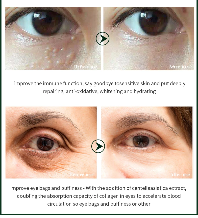 EFERO коллагеновая Сыворотка для глаз против морщин старения темных кругов ухода