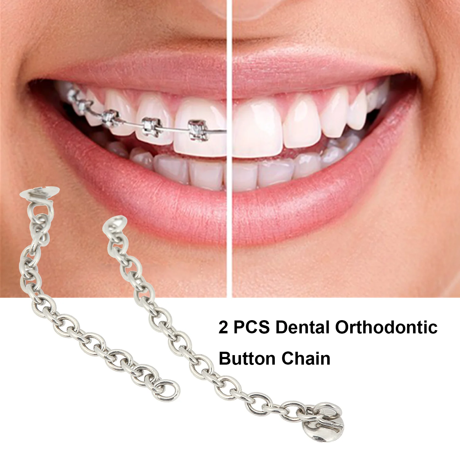 2 шт Стоматологическая Ортодонтическая Кнопка Цепь язычная Тяговая цепь