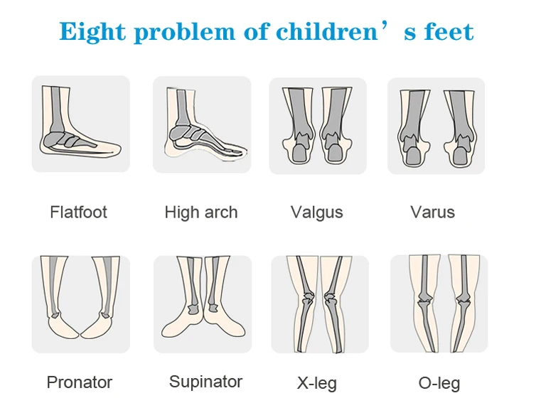 Boys Sandals Children Leather Orthopedic Shoes For Kids Girls Arch Support Hook Loop Strap Flatfeet X / O Leg Footwear8 10Years children's sandals