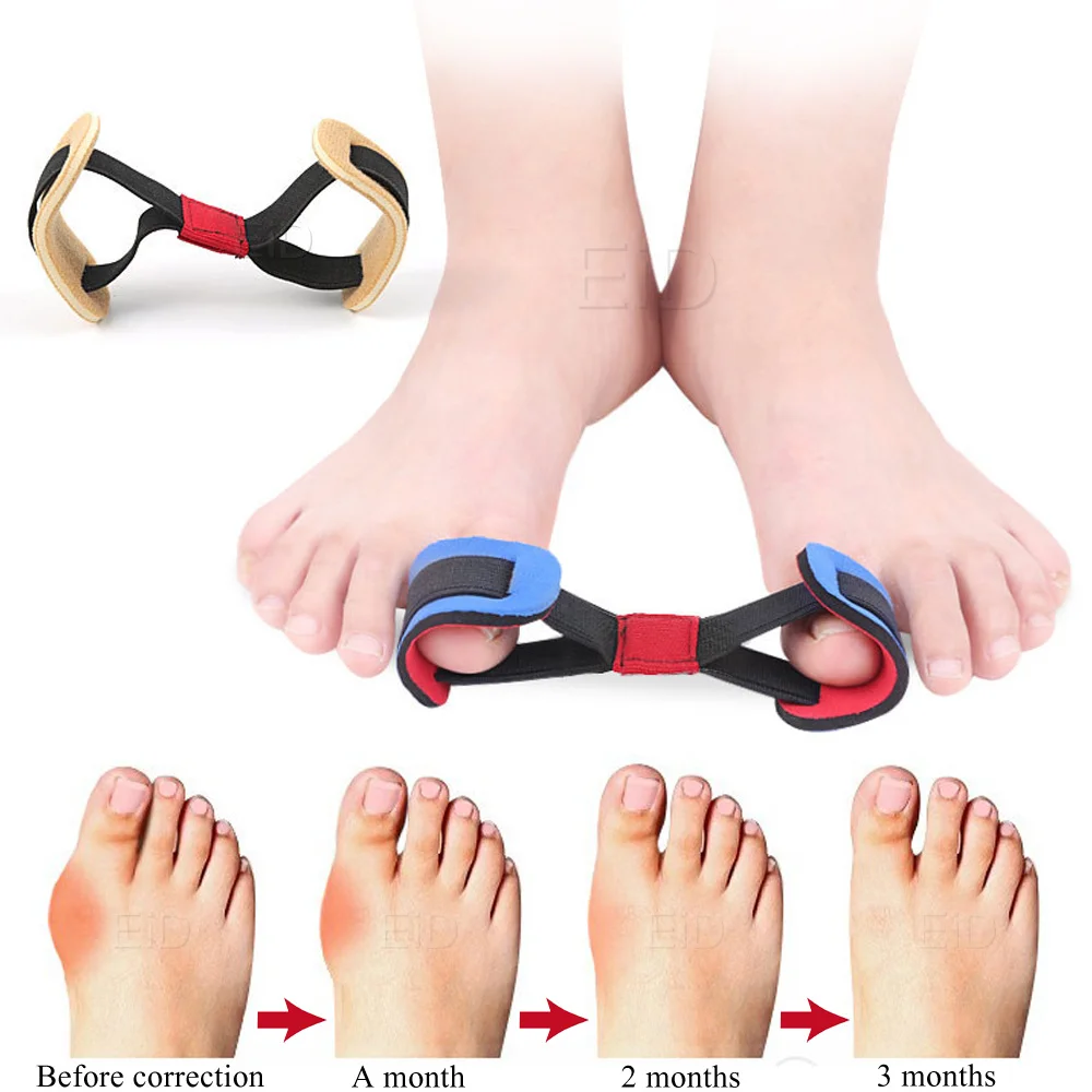 EiD Nylon Bunion Corrector Pad Stretcher Hallux Valgus Protector Guard Toe Separator Orthopädische Glätteisen Fußpflege Unisex – Detail 9