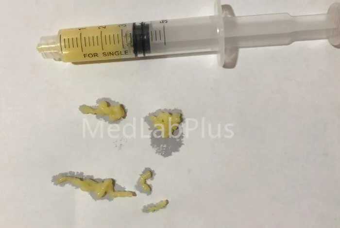 AP10 Heating 10ML plasma Gel maker PRP PPP 10ml Portable bio filler plasma machine