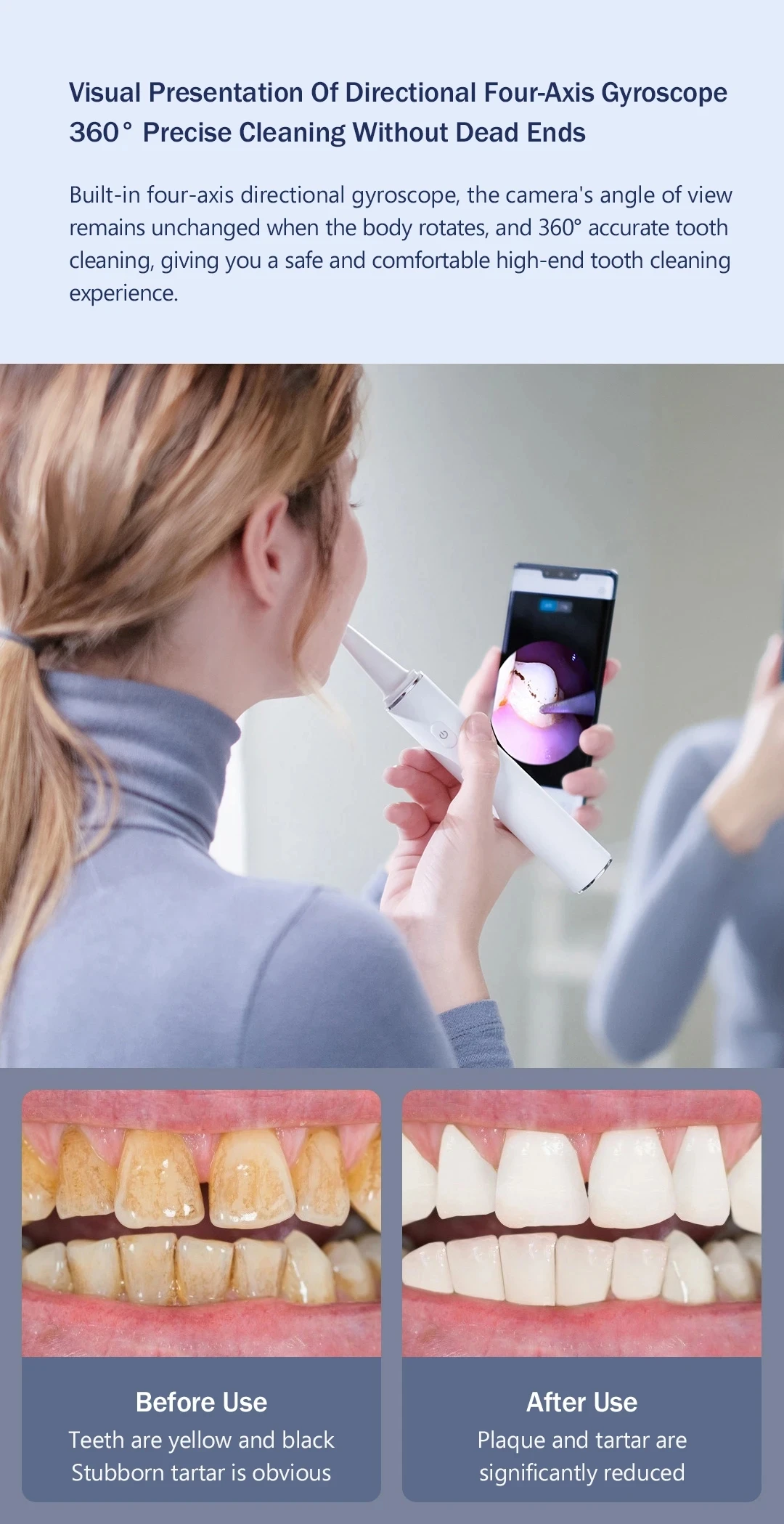 XIAOMI SUNUO inteligent Visual Ultrasonic Dental whitener Scaler Teeth