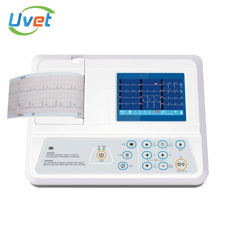 Увет оборудование для анализа патологий три каналы ecg ручной отличное автоматической интерпретацией медицинское оборудование анализатор