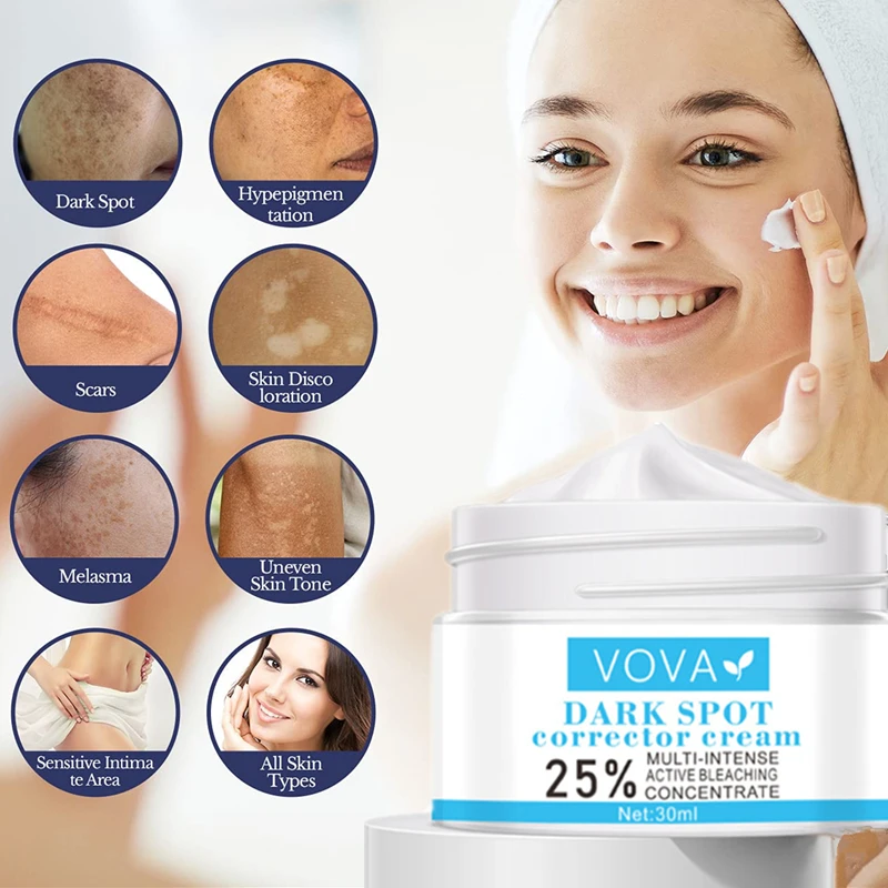 Instant Freckle Cream Remove Dark Spots Witening Cream Fade Acne Scars