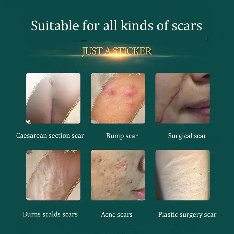 silicone remoção acne gel remendo cicatriz terapia