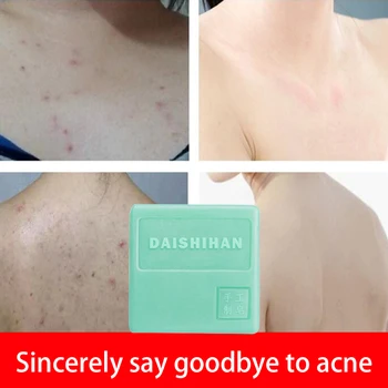 

2020 Sulphur Soap Natural Silk Foam Best Wash Bath Oil Control Remove Mites & Blackheads & Pimple & Acne Hand Soa 100g