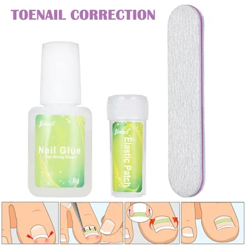 

Hot sale 12 Pcs/bottle of Ingrown Toenail Indent Correction Tool Nail Toe Pedicure Elastic Patch
