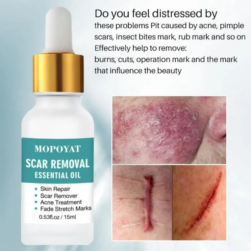 

15ml Natural Fade Acne Shrink Pores Repair Shrink Pores Serum Moisturizing Anti-wrinkle Skin Care Massage Oil Essential Oil