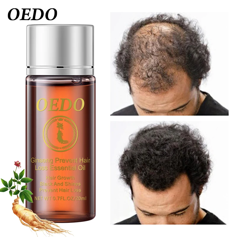 Liquid Spray OEDO Hair-Growth Regeneration-Repair Anti-Hair-Loss Essential-Oil Dry-Hair