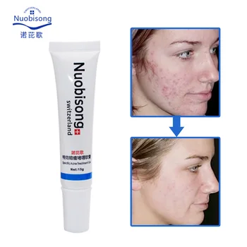 

3pcs Nuobisong face skin care treatment the face Pimples scar Stretch Marks removal acne treatment whitening moisturizing cream