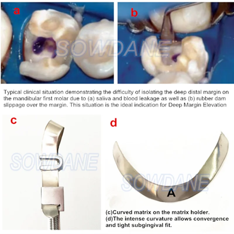 Dental-Tofflemire-Matrix-for-Deep-Margin-Elevation-Large-Curvature-Matrices-Retainer-Sectional-Contoured-Matrice-dental-Material