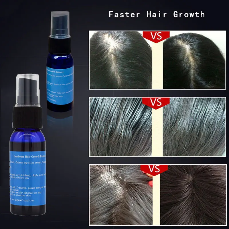 Fast Hair Growth Thickener Essence Anti-Hair Loss Treatment Hair Regrowth Baldness Beard Oil 30ml EY669 Fast Hair Growth Thickener Essence Anti-Hair Loss Treatment Hair Regrowth Baldness Beard Oil 30ml EY669
