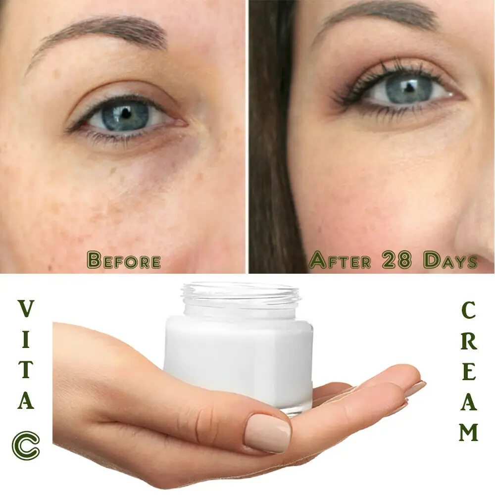 

Matrixyl 3000 Peptide Hyaluronic Acid Retinol Collagen AntiAging Vitamin C Cream