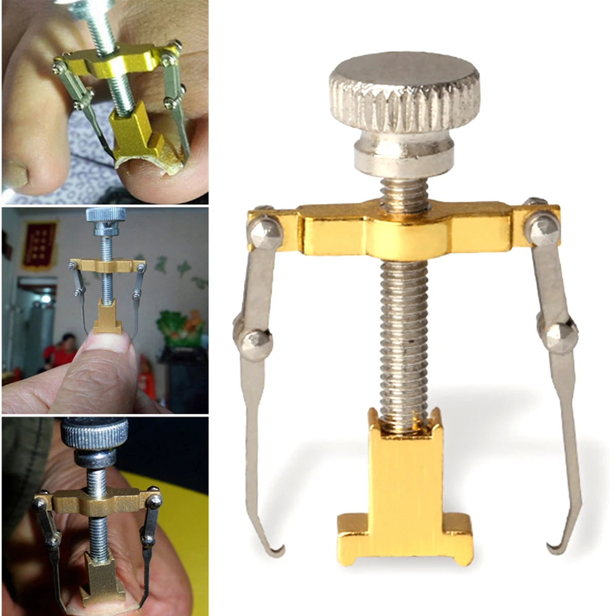 New Ingrown Toe Nail Recover Correction Tool Pedicure Toenail Fixer Foot Nail Care Tool Orthotic Nail Corrector Pedicure Tool