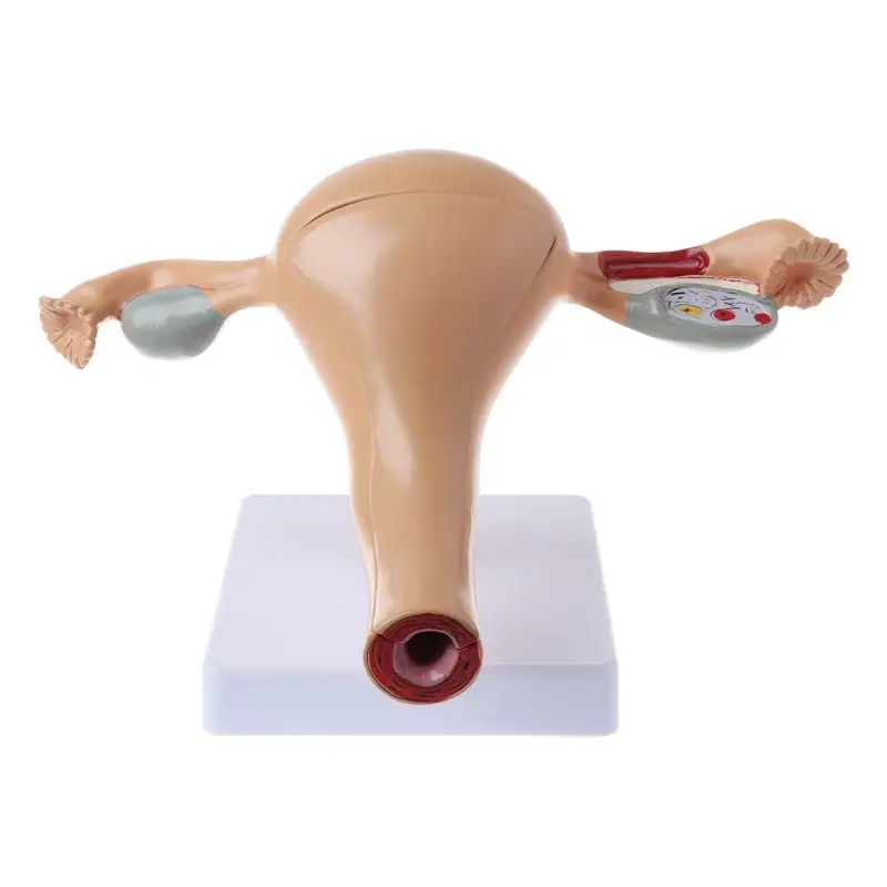

Human Pathological Uterus Ovary Model Anatomical Anatomy Disease Pathology Model For Teaching
