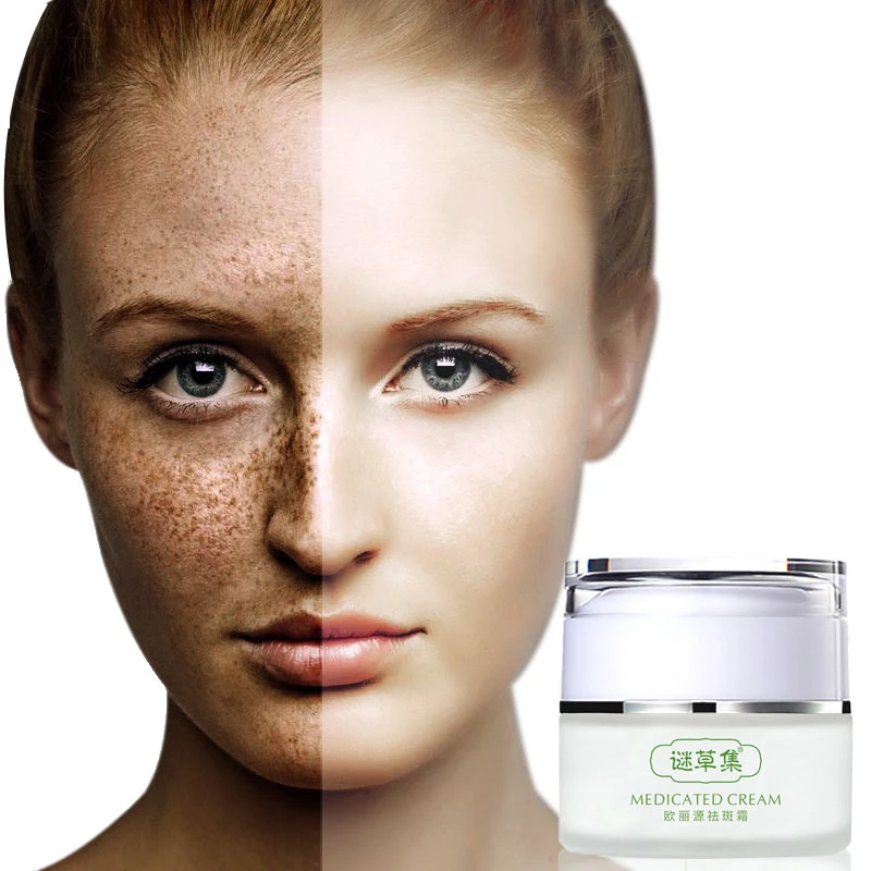Freckle Cream Fade Dark Spot Corrector Facial Skin Whitening Lightening Serum For Reduce Age