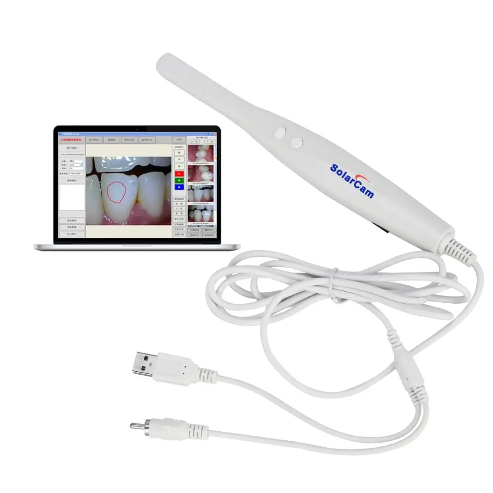  8 LED Light Dentist Oral Endoscope Dental Lab Clinic Intraoral Camera Scanner Teeth Monitoring Insp - 4000336727447