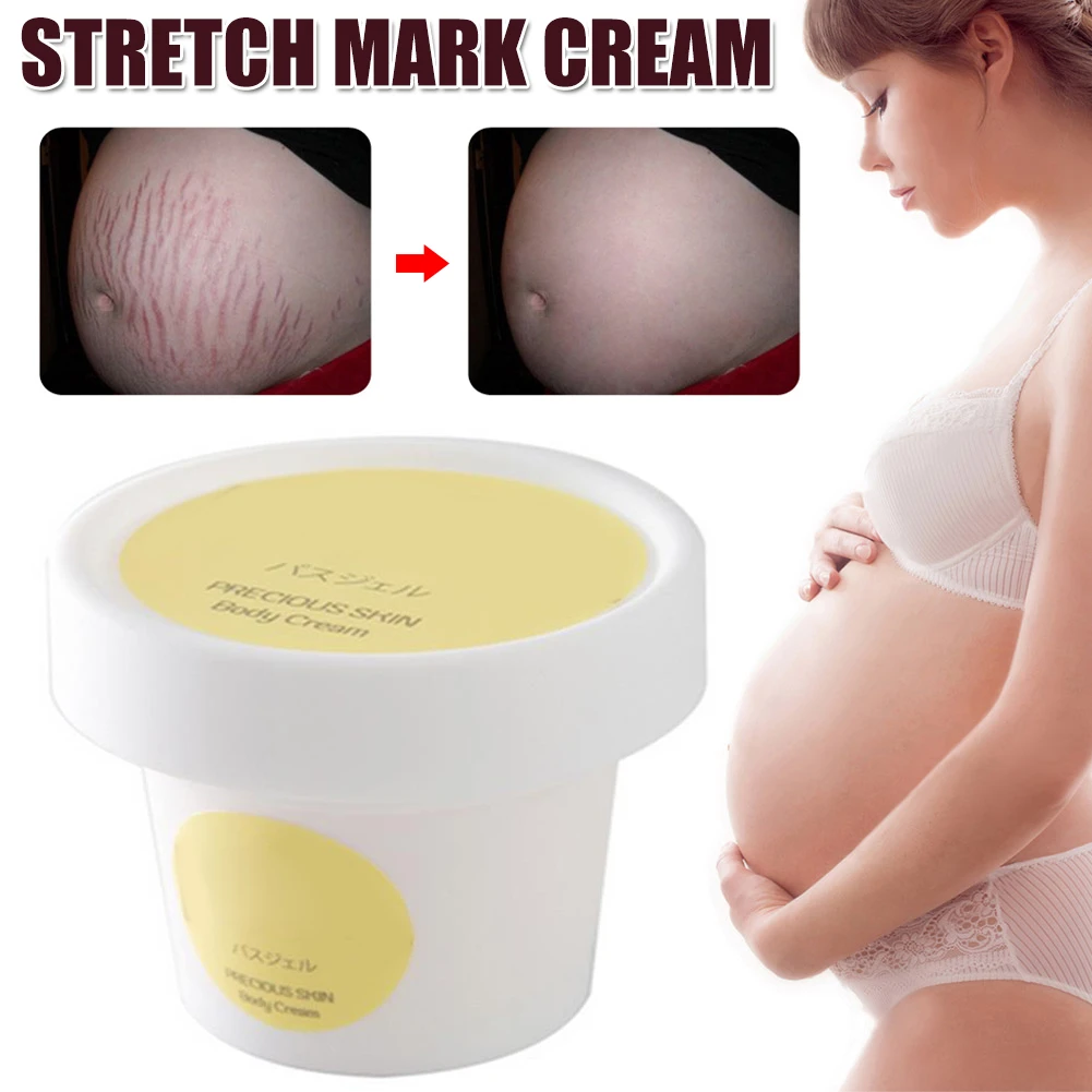 tummy stretch mark cream