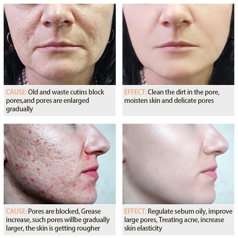 VIBRANT GLAMOUR Shrink Pores Face Serum Whitening Hyaluronic Acid Liquid Moisturizing Anti Wrinkle Face Essence Plant 2