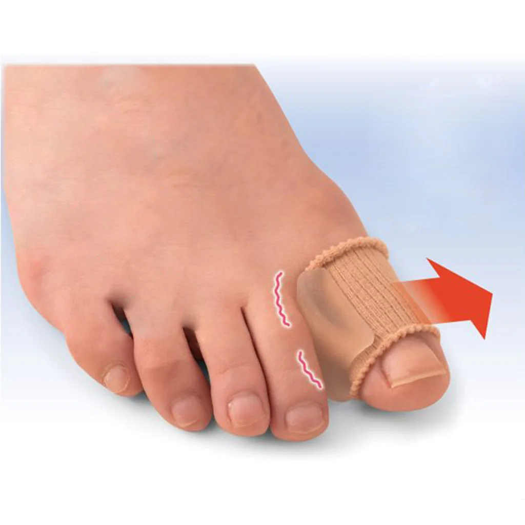 2 шт силиконовые трубки для мотоцикла для выравнивания Ног | Hallux вальгус палец ноги выпрямитель | при захождении пальцев друг на друга корректор