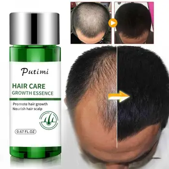 

20ML Natural Ingredients Mild Hair Loss Treatment Hair Growth Ointment Hair Care Fast Anti Hair Loss Unisex Hair Growth