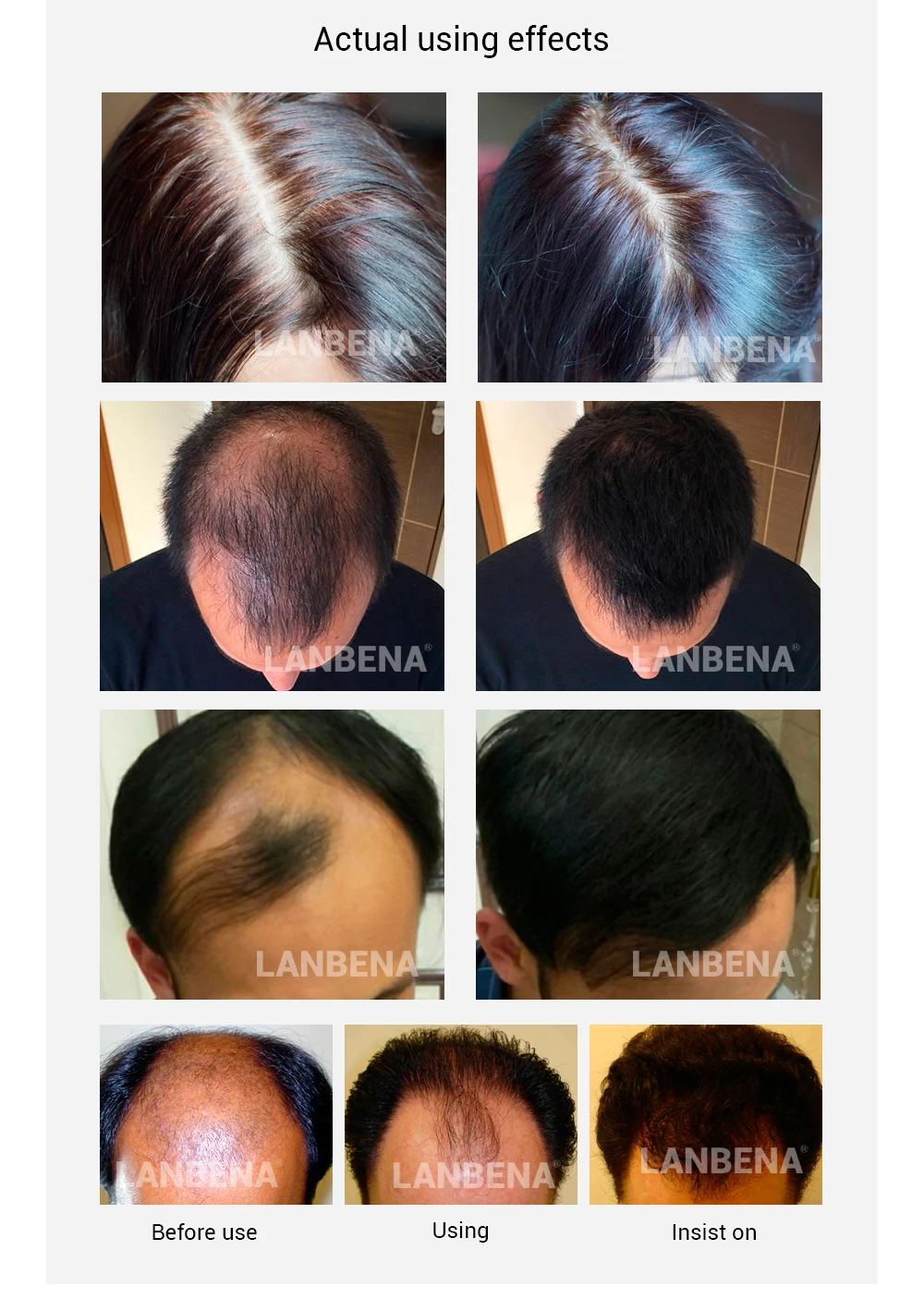 Дропшиппинг быстрое мощное средство для роста волос+ спрей 2 шт, предотвращающее облысение, укрепляющее от выпадения волос питающее Уход за волосами