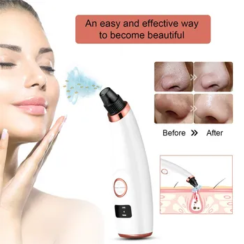 

High quailty Blackhead Remover Face Deep Pore Cleaner Removal Vacuum Suction Acne black head Care Pimples Tools