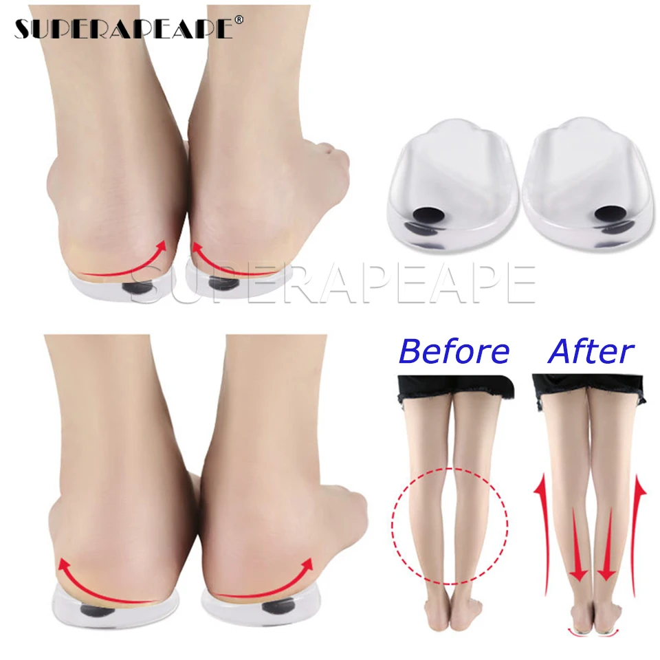 Magnetic Massage Insoles Gel O/X Type Leg Orthotics Heel Pads Corrective Valgus Varus Foot Magnet Insert | Спорт и развлечения