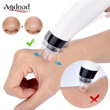 Средство для ухода за кожей лица, средство для удаления черных точек, очиститель глубоких пор, Удаление прыщей, вакуумное всасывание, спа-уход за кожей лица