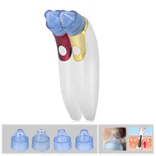 Инструмент для удаления чёрных точек от акне, Чистка Пор, пылесос, в черный горошек для маленьких девочек пятна всасывания метка на коже для удаления уход за кожей лица Уход за кожей Инструменты