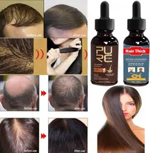 Мода 10 мл средство для роста волос уход за выпадением волос мазь для роста натуральных волос жидкость для роста