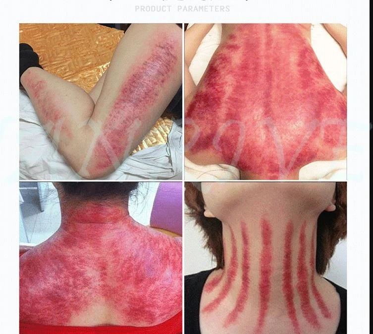 36020181014155008153