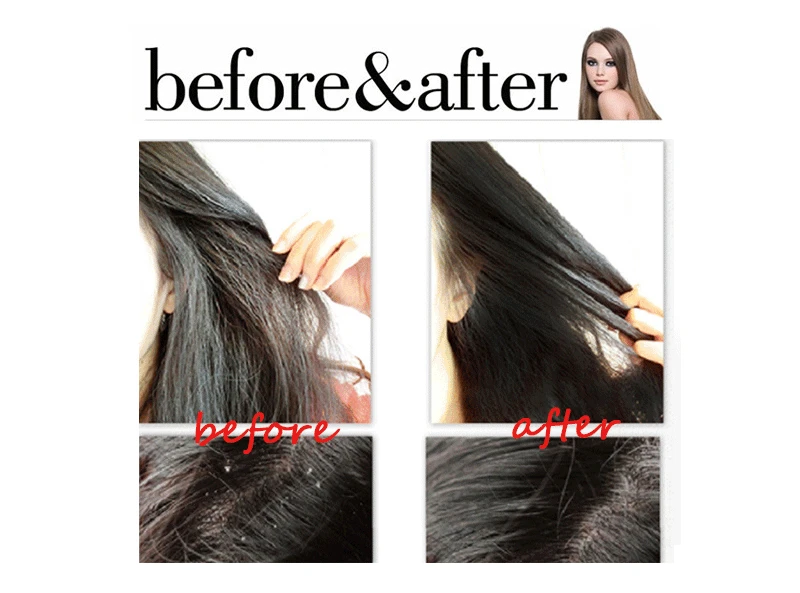 Hair Shampoo and Condtioner Set Deep Repair Moisturize Professional Daily Care After Keratin Treatment Hair Health Hair Shampoo and Condtioner Set Deep Repair Moisturize Professional Daily Care After Keratin Treatment Hair Health