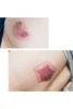1Set of 10 Pieces Love Shape Cupping Cups Set Suction Cups Jar Set Plastic Vacuum Suction Therapy Cupping Set Cans for Massage 3