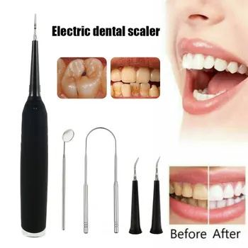 

Electric Sonic Oral Irrigator Dental Scaler Calculus Remover Tartar Whitening USB Recharge Tooth Cleaner Teeth Health Hygiene