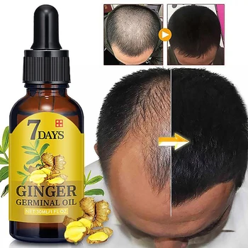 

30ml 7 Day Ginger Germinal Oil Serum Essence Oil Natural Hair Loss Treatement Effective Fast Growth Hair Care Essence Serum